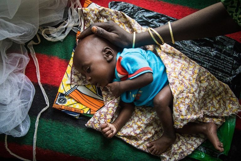 Afrique du Sud: les enfants confrontés à une crise silencieuse de la malnutrition (ONG)