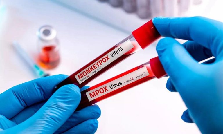 Kenya: 02 nouveaux cas de Mpox confirmés portant le total à 7 (Santé)