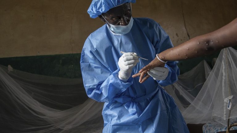 Congo-Brazzaville: vers l’élaboration d’un plan de vaccination contre le Mpox